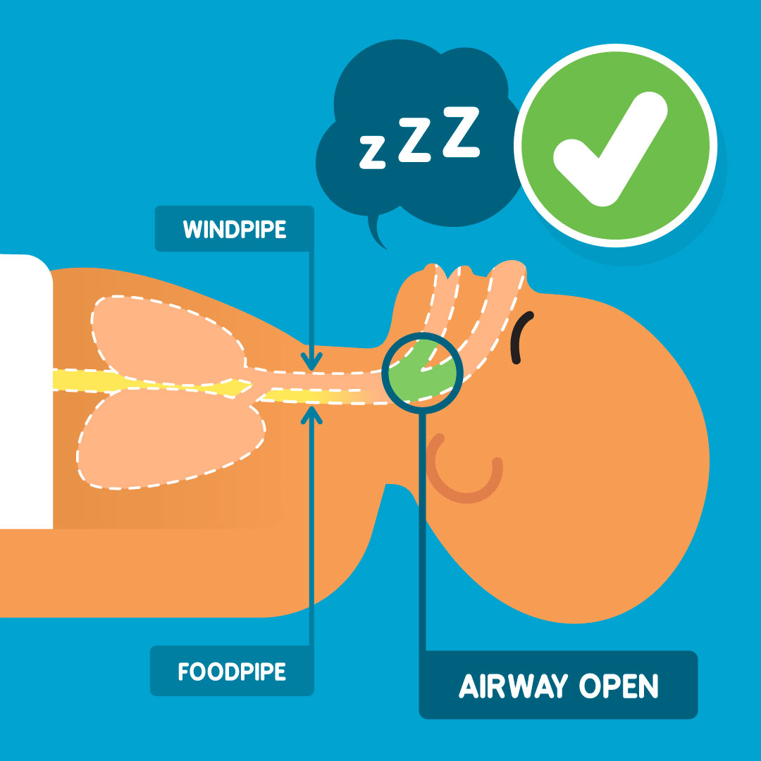 baby's airway open anatomy laid on back breathing