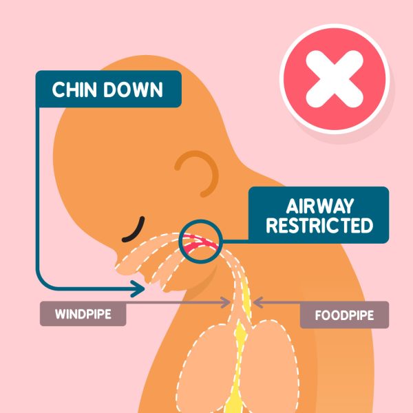 How to keep a sleeping baby's breathing tube (airway) open - The ...